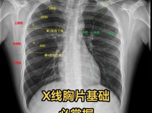 超大胸片曝光：为什么需要拍？如何拍？怎样看？