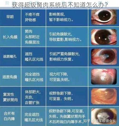 获得超级胬肉系统后不知道怎么办？