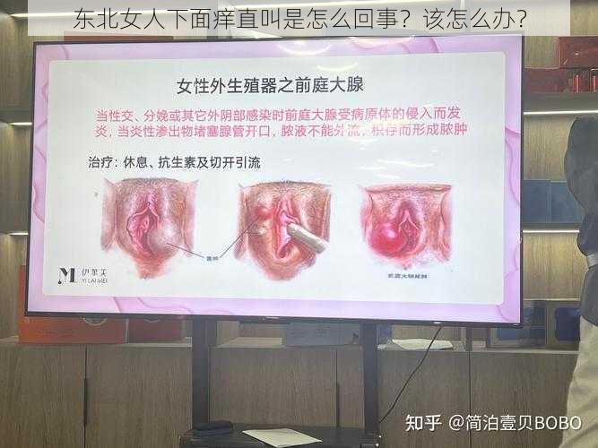 东北女人下面痒直叫是怎么回事？该怎么办？